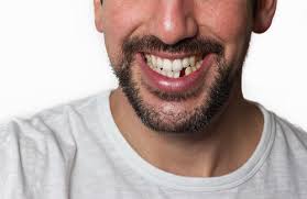 The Cost of not Replacing a Missing Tooth